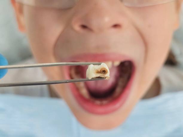 Best Emergency Dentist for Kids  in Mount Airy, MD